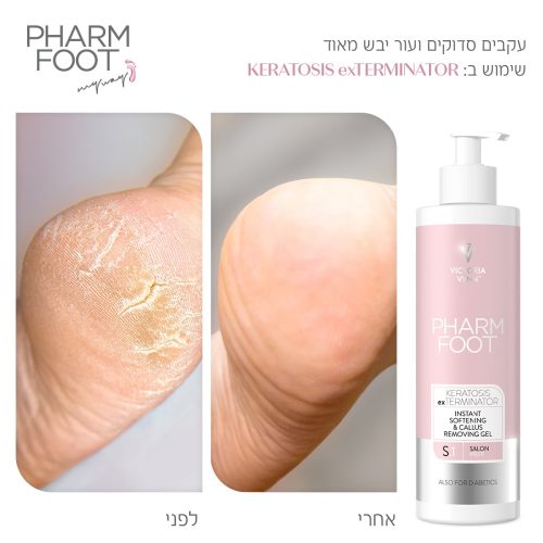 ג'ל להסרת קאלוס ויבלות - Pharm Foot | 300 ml | KERATOSIS exTERMINATOR ג'ל להסרת קאלוס ויבלות - Pharm Foot | 300 ml | KERATOSIS exTERMINATOR