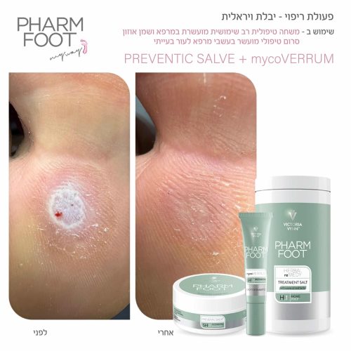 סרום טיפולי מועשר בעשבי מרפא לעור בעייתי - Pharm Foot | 15 ml | mycoVERRUM סרום טיפולי מועשר בעשבי מרפא לעור בעייתי - Pharm Foot | 15 ml | mycoVERRUM