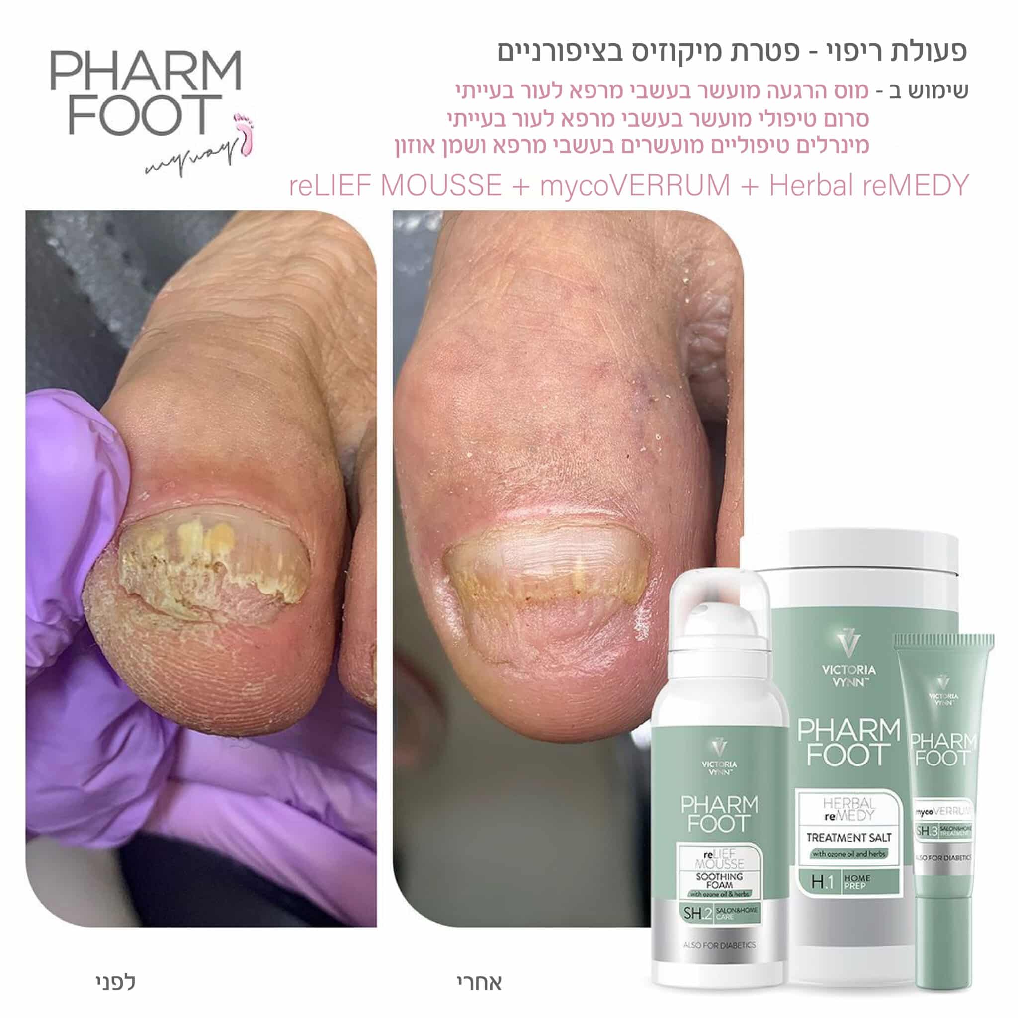 סרום טיפולי מועשר בעשבי מרפא לעור בעייתי - Pharm Foot | 15 ml | mycoVERRUM photo number 1