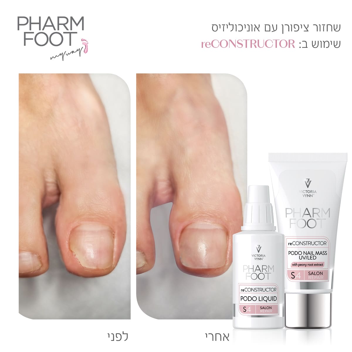 ערכה לשחזור ושיקום מבנה הציפורן - Pharm Foot | reCONSTRUCTOR photo number 1