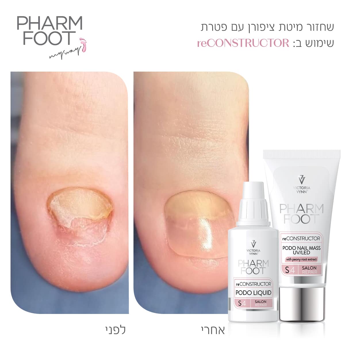 ערכה לשחזור ושיקום מבנה הציפורן - Pharm Foot | reCONSTRUCTOR photo number 1