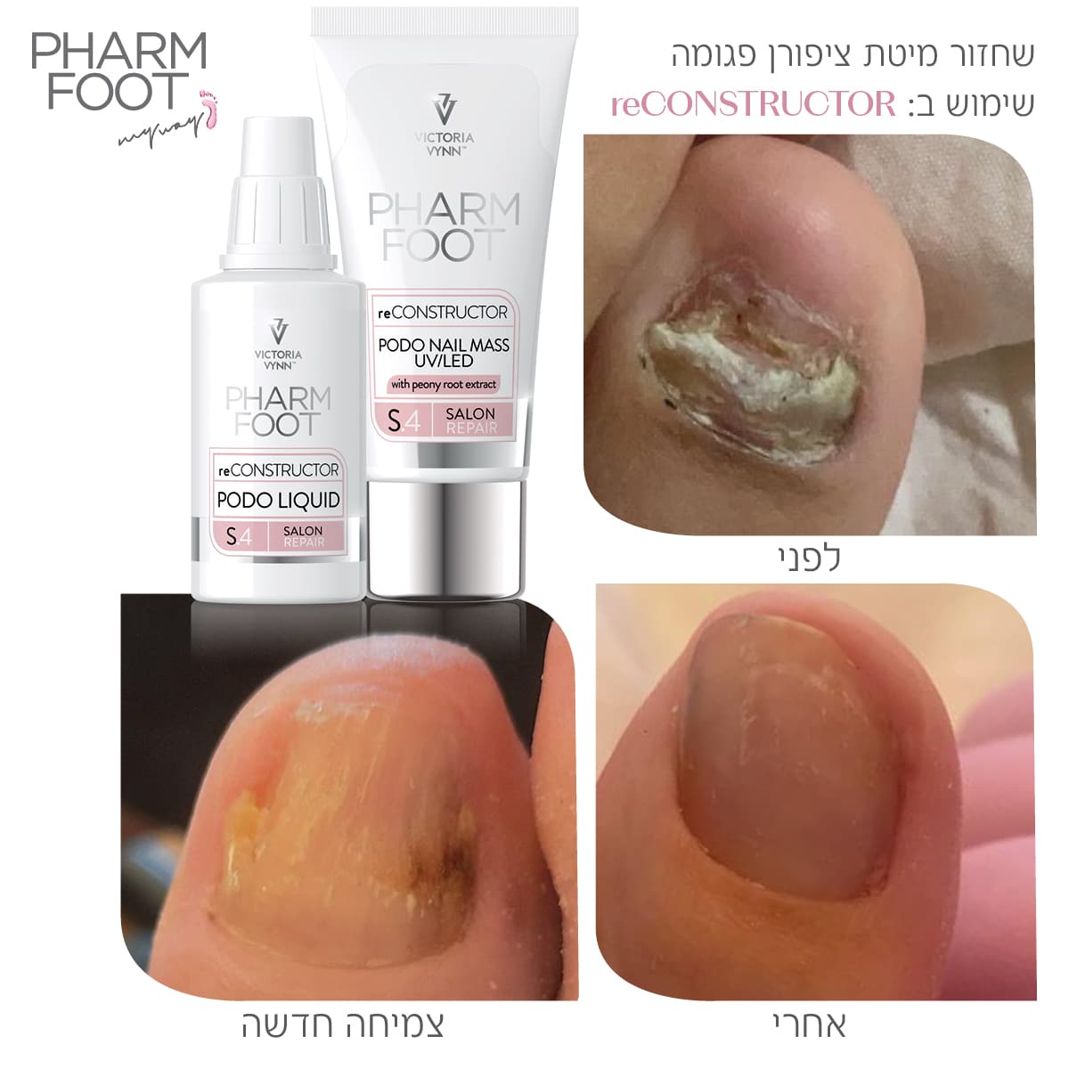 ערכה לשחזור ושיקום מבנה הציפורן - Pharm Foot | reCONSTRUCTOR photo number 1