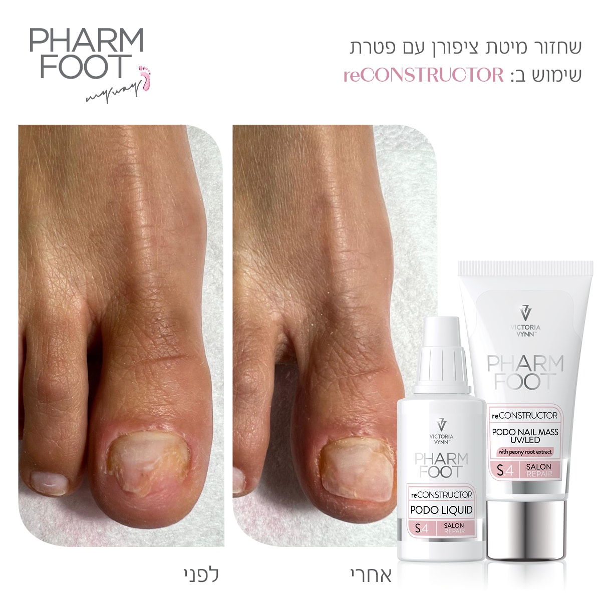 ערכה לשחזור ושיקום מבנה הציפורן - Pharm Foot | reCONSTRUCTOR photo number 1
