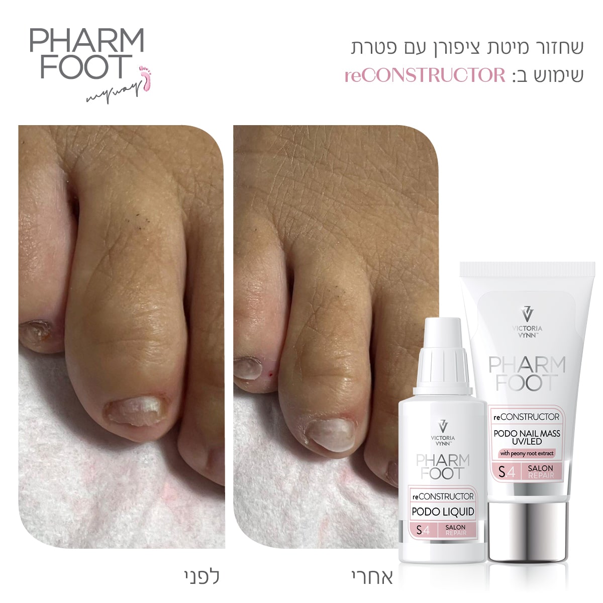 ערכה לשחזור ושיקום מבנה הציפורן - Pharm Foot | reCONSTRUCTOR photo number 1