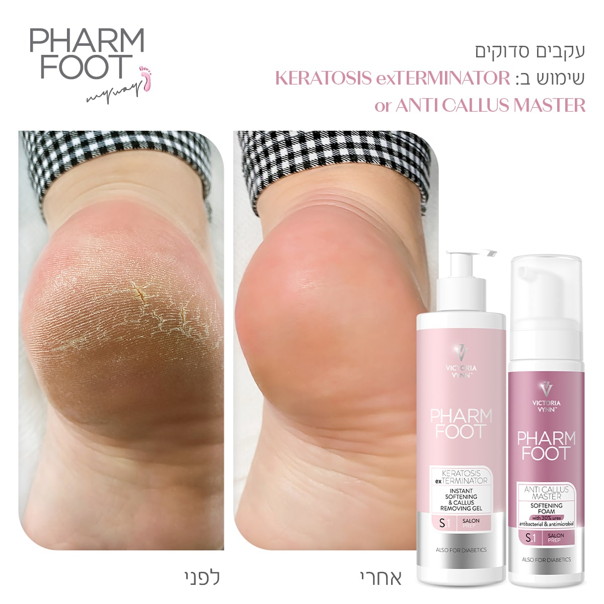קצף להסרת קאלוס - Pharm Foot | 200 ml | ANTI CALLUS MASTER photo number 1
