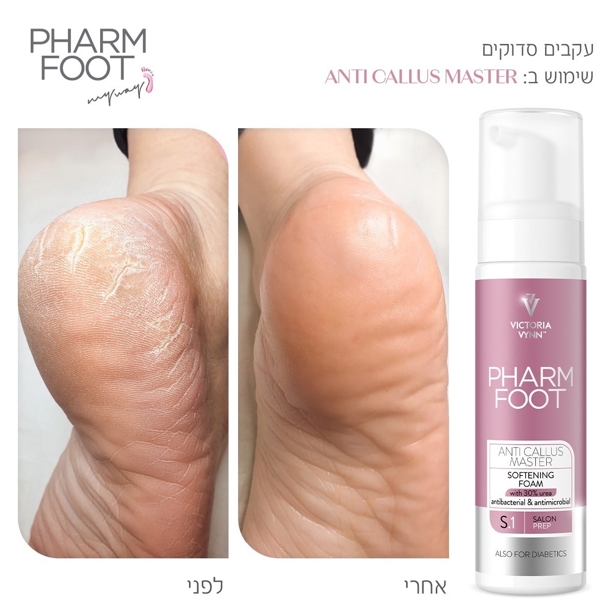 קצף להסרת קאלוס - Pharm Foot | 200 ml | ANTI CALLUS MASTER photo number 1