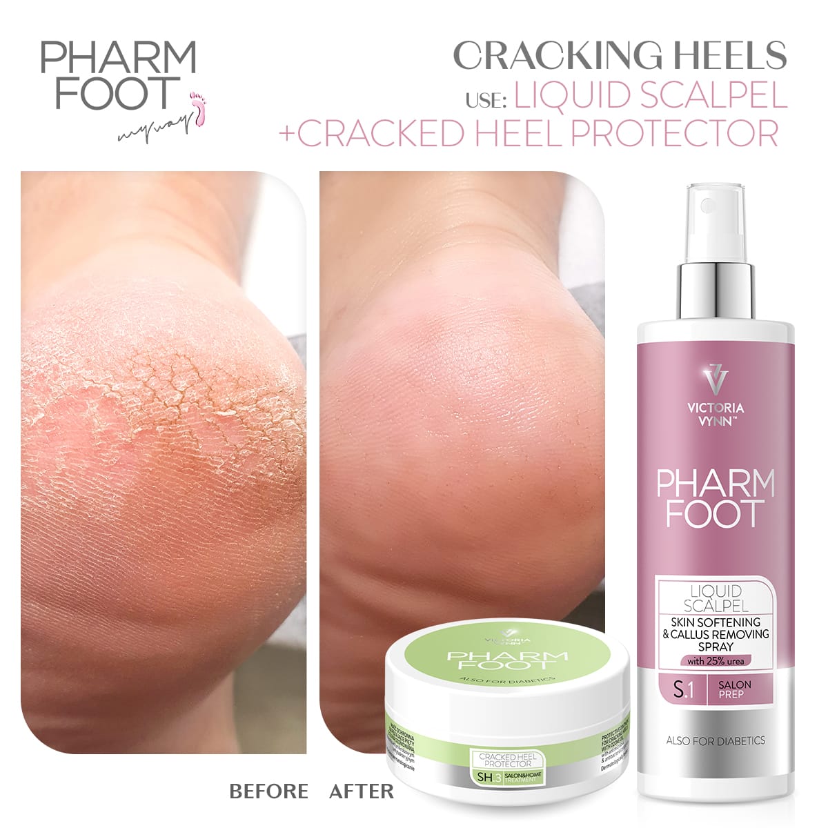 קרם אוזון לטיפול בעקבים סדוקים - Pharm Foot | 200 ml | CRACKED HEEL PROTECTOR photo number 1