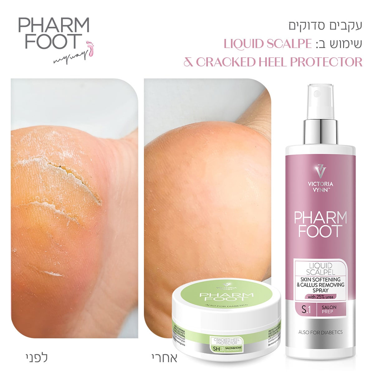 קרם אוזון לטיפול בעקבים סדוקים - Pharm Foot | 75 ml | CRACKED HEEL PROTECTOR photo number 1