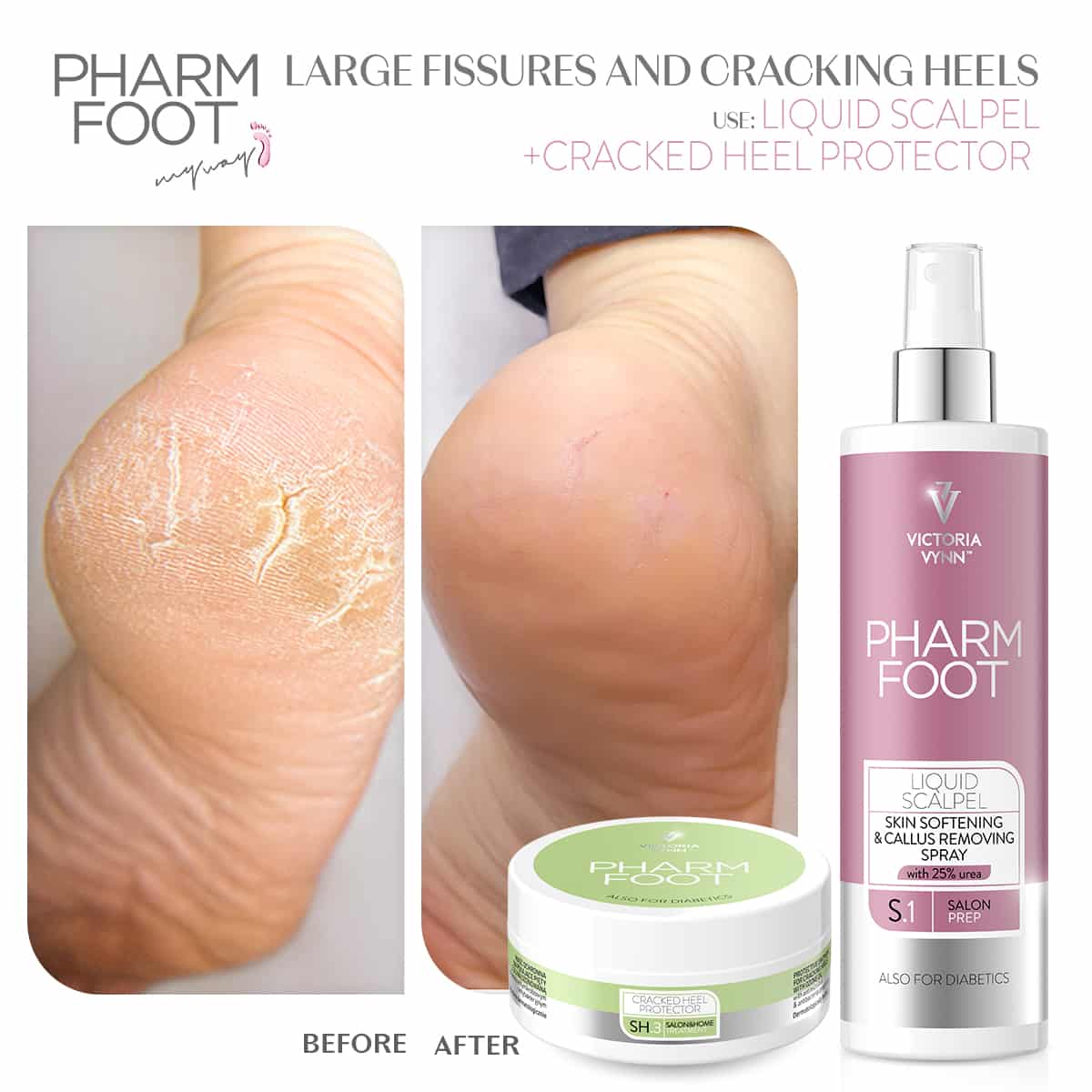 קרם אוזון לטיפול בעקבים סדוקים - Pharm Foot | 75 ml | CRACKED HEEL PROTECTOR photo number 1