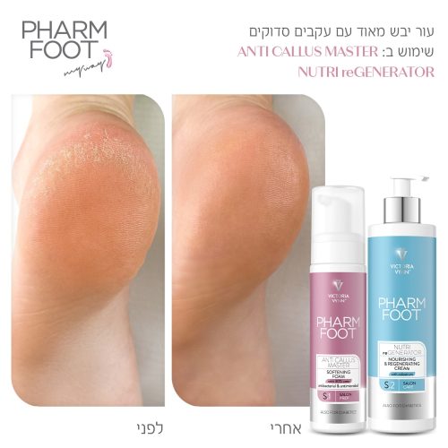 קרם קולוסטרום להזנה ושיקום עור הרגליים - Pharm Foot | 400 ml | NUTRI reGENERATOR קרם קולוסטרום להזנה ושיקום עור הרגליים - Pharm Foot | 400 ml | NUTRI reGENERATOR